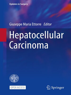 cover image of Hepatocellular Carcinoma